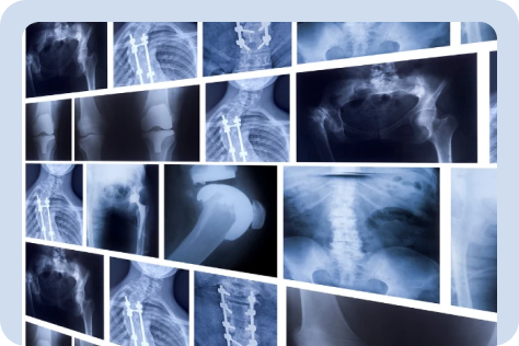 BeaconHealth Diagnostics